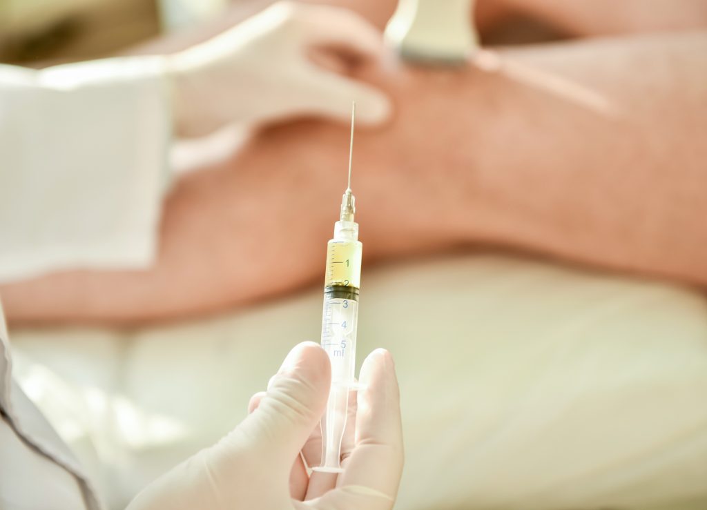 How Does PRP Therapy Work to Alleviate Pain?