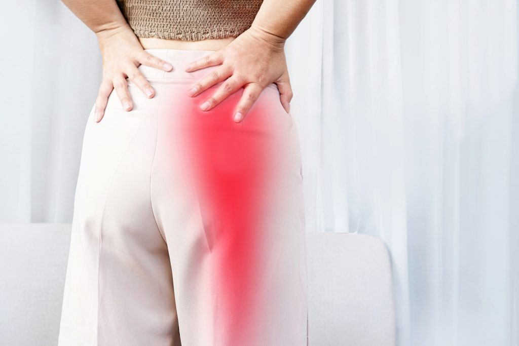 Can Piriformis Syndrome Cause Symptoms Besides Buttock and Leg Pain?
