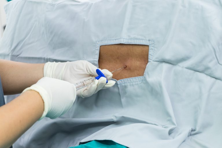 Triangular Nerve Block Patch Occipital Nerve Block | Pain Treatment Procedure