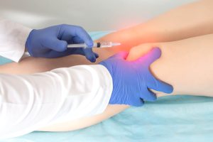 How Long Does PRP Take to Work for Pain?