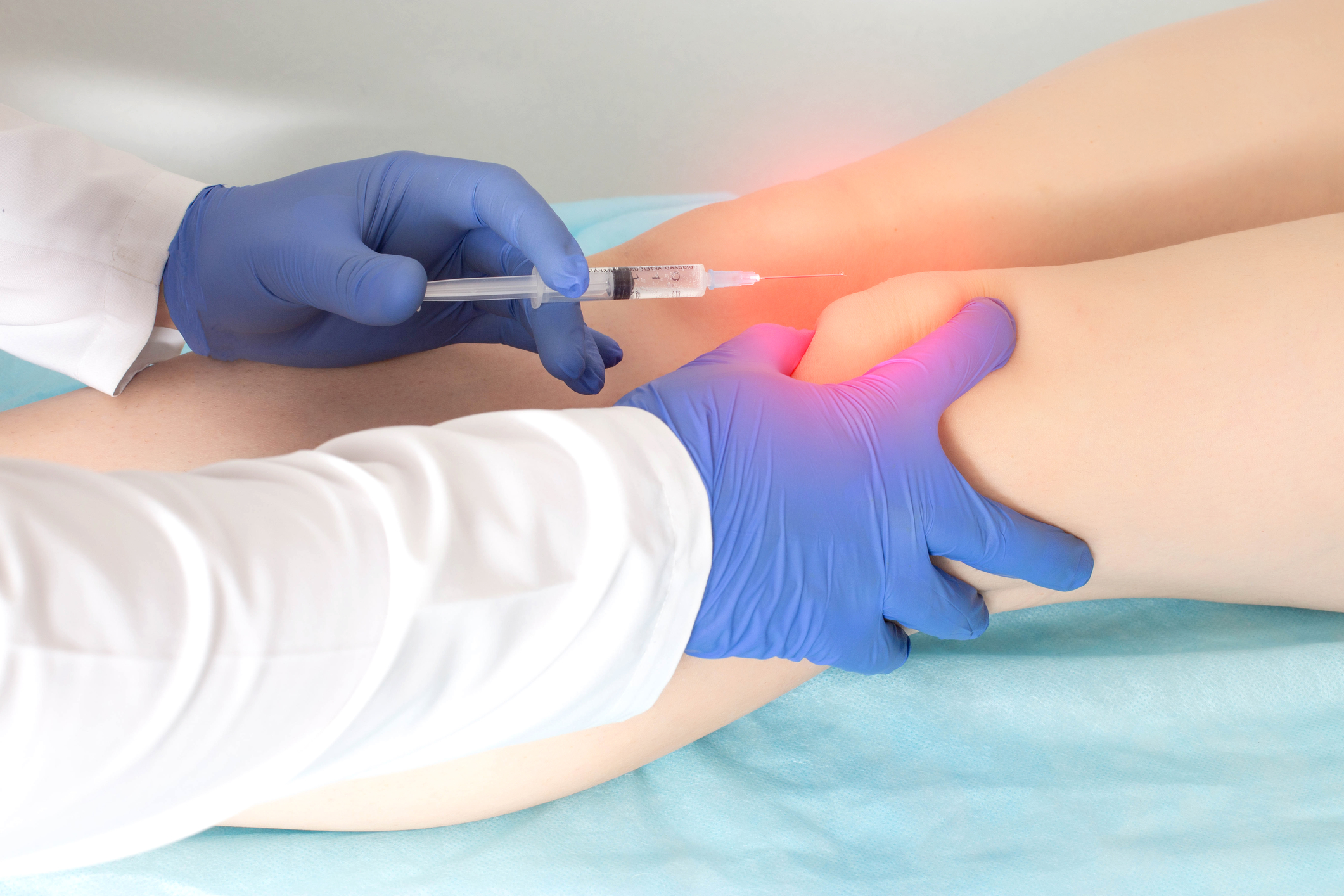 How Long Does PRP Take to Work for Pain?