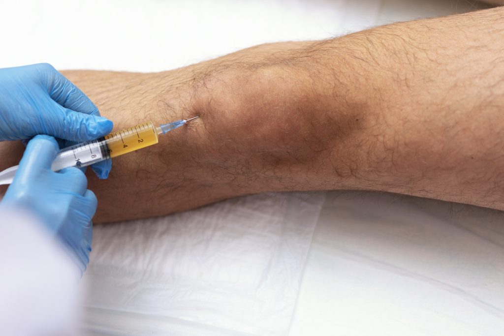 Who Is a Good Candidate for Regenerative Medicine?